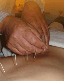 Dr. Zhang's Acupuncture & Chinese Herbs Clinic